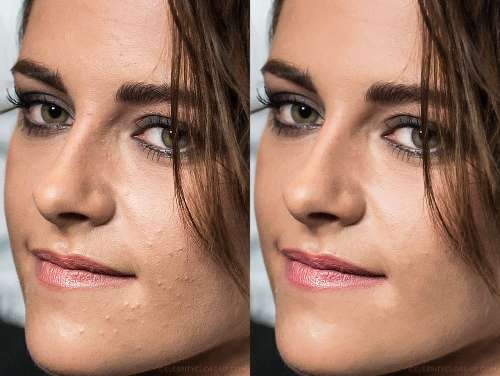 Ảnh before after
