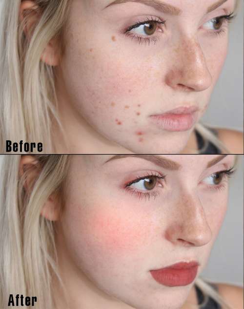 Before - After