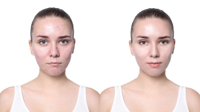 Before & After