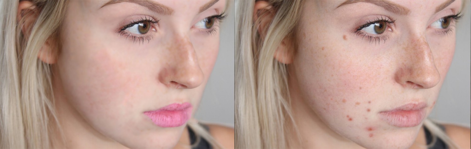 retouch