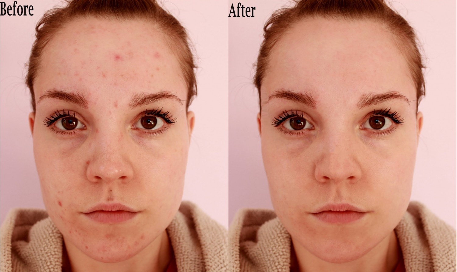 Retouch