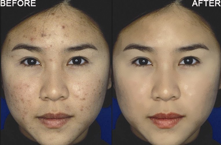 Retouch 23.8
