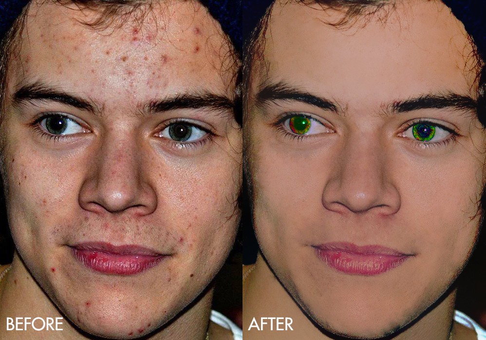 BTVN retouch