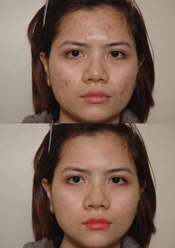 Retouch