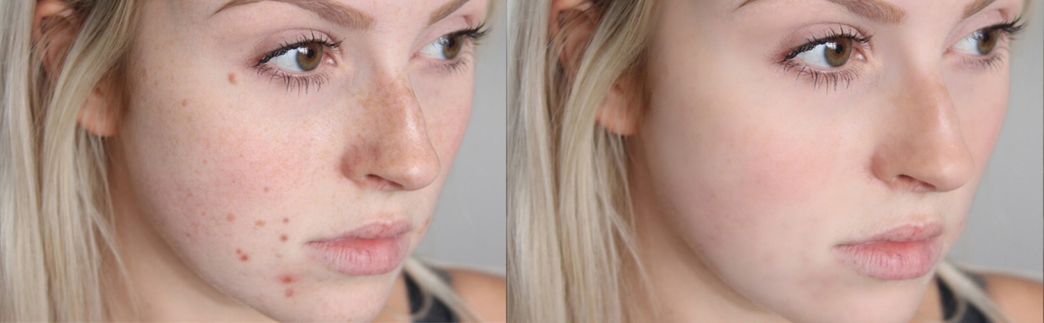 RETOUCH 