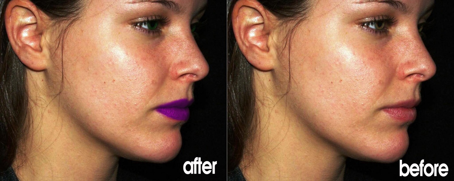 retouch