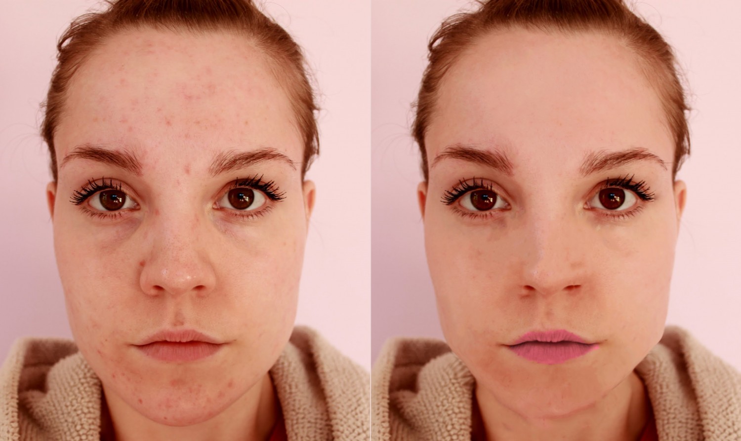 Before-After