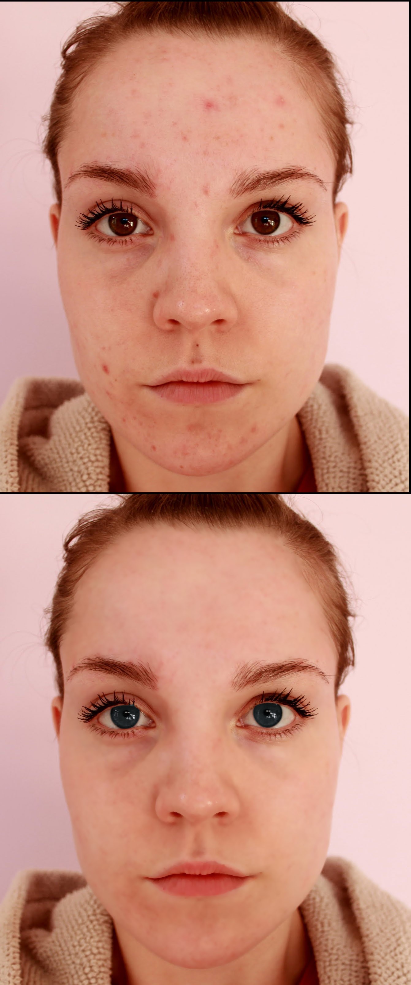 retouch