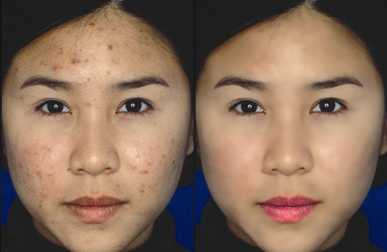 before-after