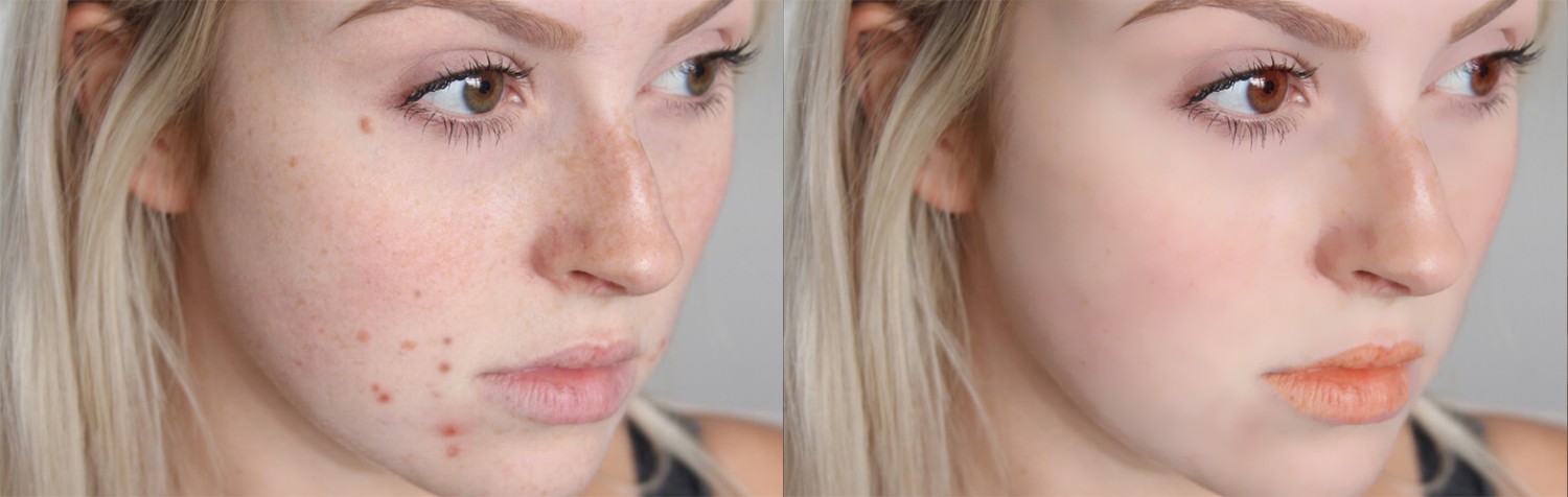 Before - After